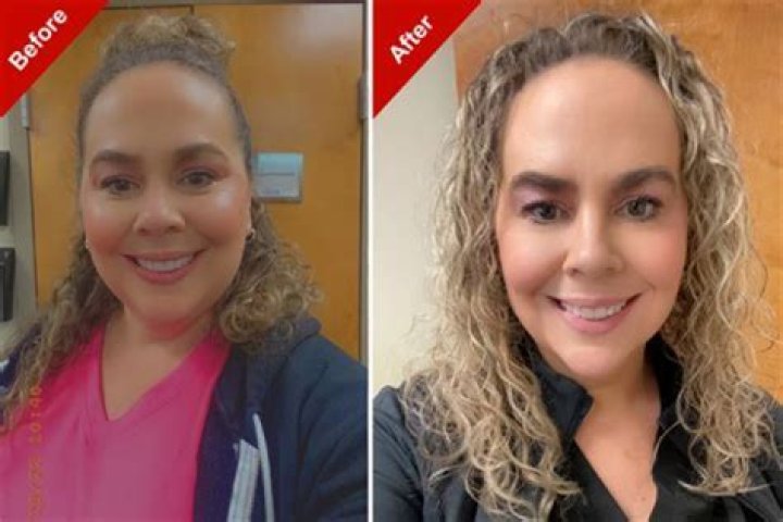 Kimberly's Transformation: Before And After Surgery