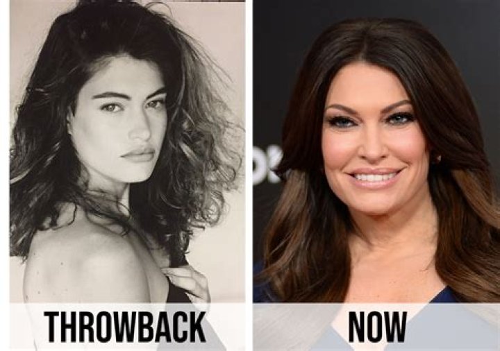 Unveiling The Transformation: Kimberly Guilfoyle's Cosmetic Surgery Journey